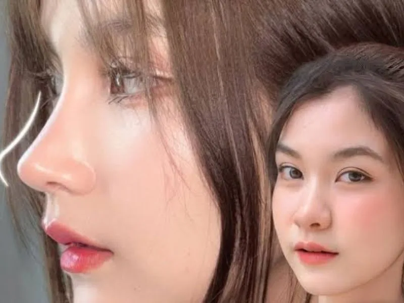 nang mui het bao nhieu tien cap nhat chi phi nang mui moi nhat